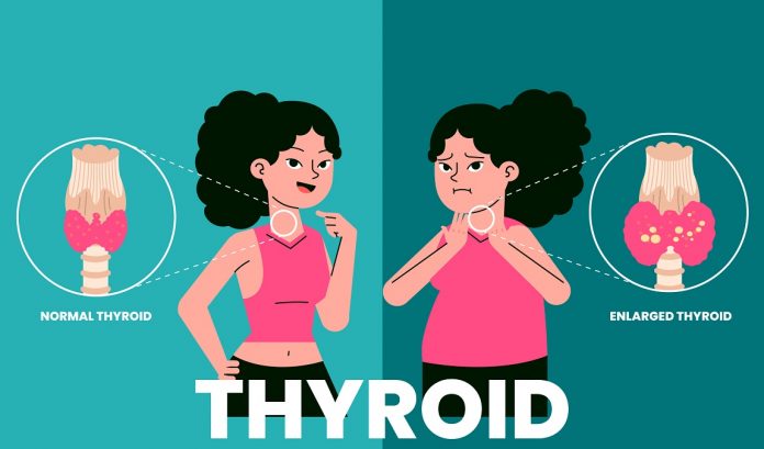 Early Symptoms of Thyroid Cancer